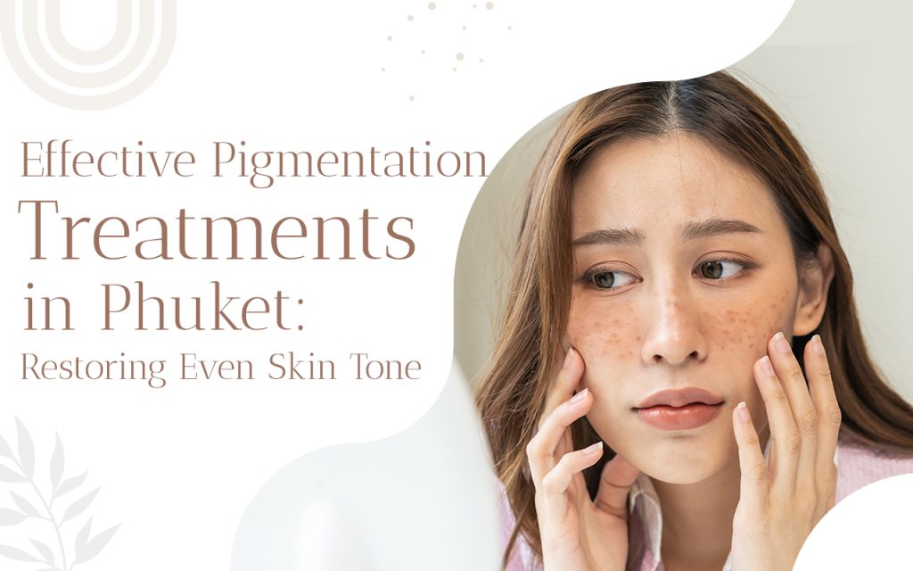 Pigmentation Treatment Phuket