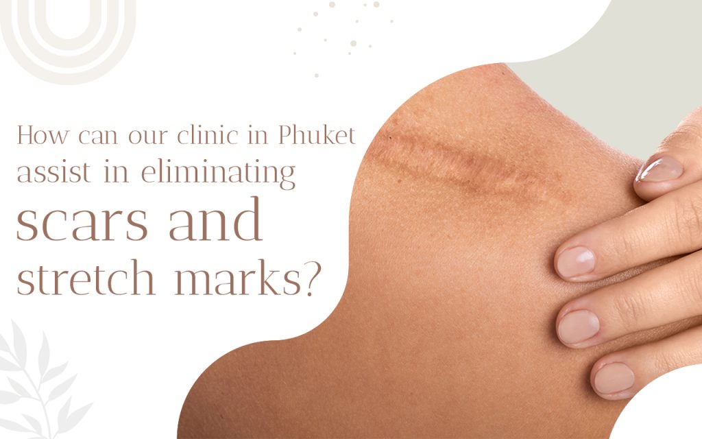 scar removal in phuket