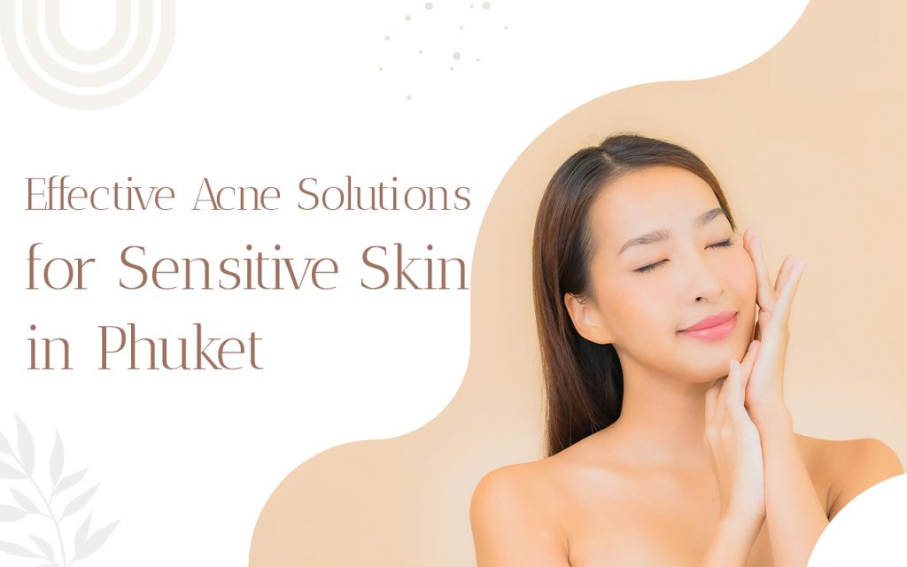 acne solutions in Phuket